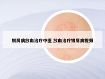 银屑病放血治疗中医 放血治疗银屑病视频