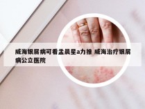 威海银屑病可看孟晨星a力推 威海治疗银屑病公立医院