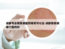 成都专业银屑病医院哪家可以治 成都银屑病哪个医院好