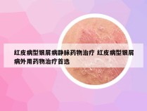 红皮病型银屑病静脉药物治疗 红皮病型银屑病外用药物治疗首选