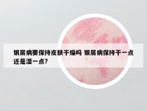 银屑病要保持皮肤干燥吗 银屑病保持干一点还是湿一点?