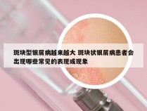 斑块型银屑病越来越大 斑块状银屑病患者会出现哪些常见的表现或现象