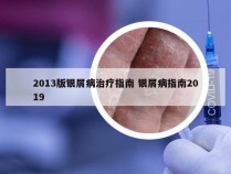 2013版银屑病治疗指南 银屑病指南2019