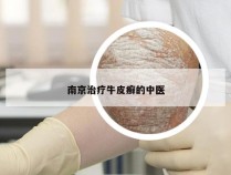 南京治疗牛皮癣的中医
