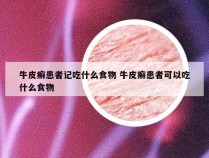 牛皮癣患者记吃什么食物 牛皮癣患者可以吃什么食物