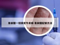 象椒醋一招搞定牛皮癣 象椒醋配制方法