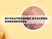 新乡专业治疗银屑病的医院 新乡治疗银屑病郑州银屑病研究院地址