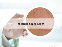 牛皮癣骂人是什么意思