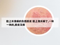 脸上长像癣的东西脱皮 脸上像长癣了,一块一块的,脱皮又痒