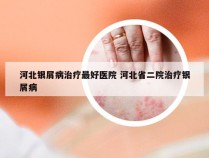 河北银屑病治疗最好医院 河北省二院治疗银屑病