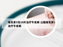 维生素C吃10片治疗牛皮癣 口服维生素c治疗牛皮癣