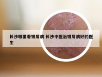 长沙哪里看银屑病 长沙中医治银屑病好的医生