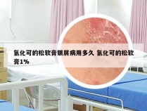 氢化可的松软膏银屑病用多久 氢化可的松软膏1%
