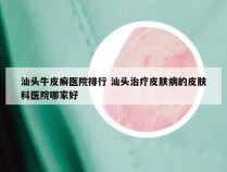 汕头牛皮癣医院排行 汕头治疗皮肤病的皮肤科医院哪家好