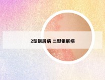 2型银屑病 二型银屑病
