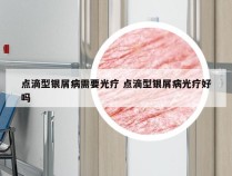 点滴型银屑病需要光疗 点滴型银屑病光疗好吗
