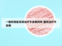 一般药房能买到治疗牛皮癣药吗 医院治疗牛皮癣
