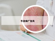 牛皮癣广告风
