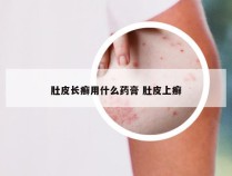 肚皮长癣用什么药膏 肚皮上癣