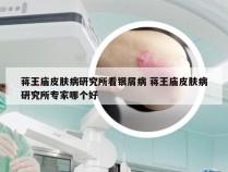 蒋王庙皮肤病研究所看银屑病 蒋王庙皮肤病研究所专家哪个好