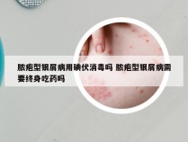 脓疱型银屑病用碘伏消毒吗 脓疱型银屑病需要终身吃药吗