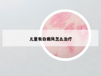 儿童有白癜风怎么治疗