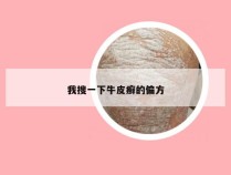 我搜一下牛皮癣的偏方