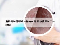 胳肢窝长得跟癣一样的东西 胳肢窝里长了一块癣