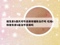 维生素b族片对牛皮癣有辅助治疗吗 吃维c和维生素b能治牛皮癣吗