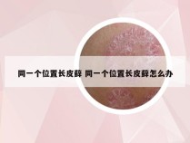 同一个位置长皮藓 同一个位置长皮藓怎么办