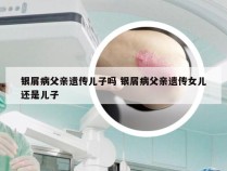 银屑病父亲遗传儿子吗 银屑病父亲遗传女儿还是儿子