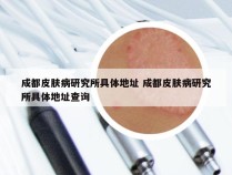 成都皮肤病研究所具体地址 成都皮肤病研究所具体地址查询