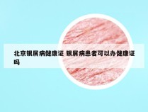 北京银屑病健康证 银屑病患者可以办健康证吗