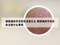银屑病关节炎饮食注意什么 银屑病关节炎饮食注意什么事项