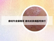 廊坊牛皮癣哪家 廊坊皮肤病医院排行
