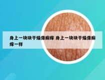 身上一块块干燥像癣痒 身上一块块干燥像癣痒一样