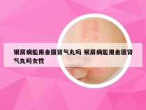银屑病能用金匮肾气丸吗 银屑病能用金匮肾气丸吗女性