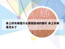 身上好长癣是什么原因造成的图片 身上长癣是怎么了