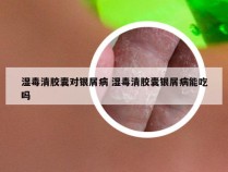 湿毒清胶囊对银屑病 湿毒清胶囊银屑病能吃吗