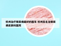 杭州治疗银屑病最好的医生 杭州出名治银屑病皮肤科医院