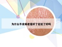 为什么牛皮癣老是好了犯犯了好吗