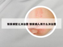 银屑病婴儿沐浴露 银屑病人用什么沐浴露
