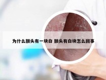 为什么额头有一块白 额头有白块怎么回事