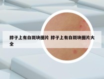脖子上有白斑块图片 脖子上有白斑块图片大全