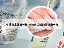 小孩身上像癣一样 小孩身上起的好像癣一样