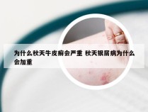 为什么秋天牛皮癣会严重 秋天银屑病为什么会加重