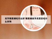 关节银屑病吃付么好 银屑病关节炎禁忌吃什么食物