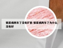 银屑病两年了没有扩散 银屑病两年了为什么没有好
