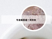 牛皮癣患者一天饮食