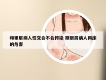 和银屑病人性交会不会传染 跟银屑病人同床的危害